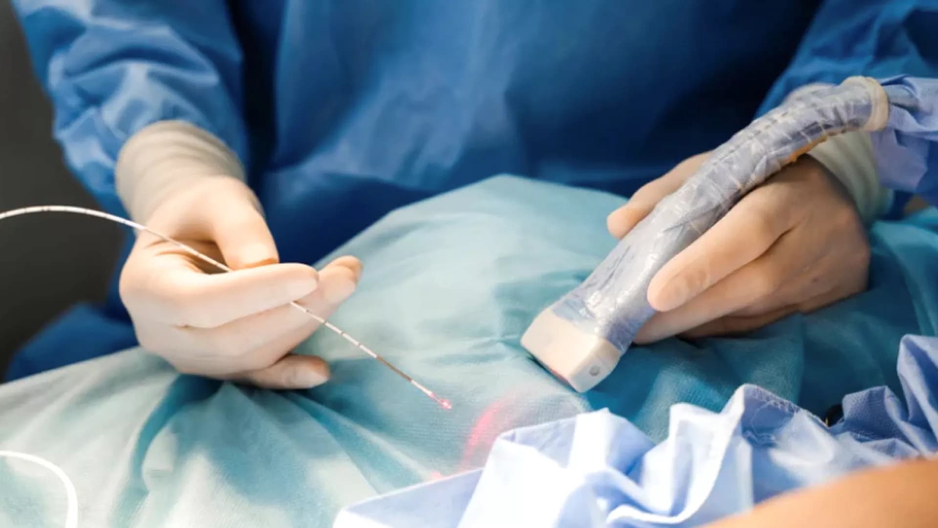 การผ่าตัดหมอนรองกระดูกสันหลังด้วยเลเซอร์ 