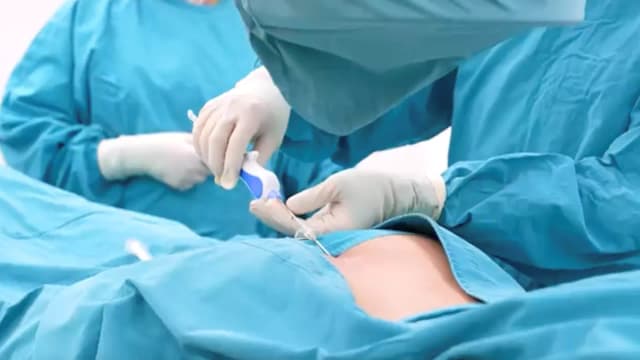 การฉีดยาสลายพังผืดในโพรงประสาทสันหลัง (P.E.N)