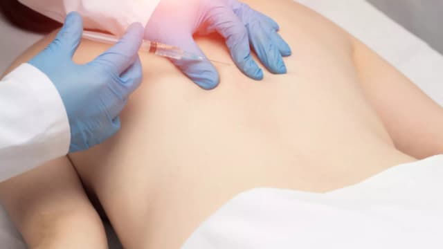 การฉีดยาลดปวดเข้ากล้ามเนื้อ